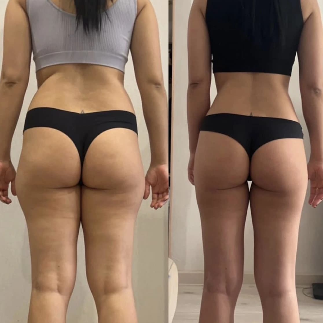 Transformation cliente ChedlyFit 6